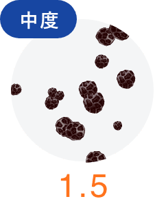 中度
