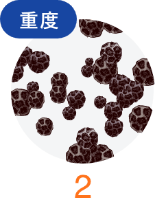 重度